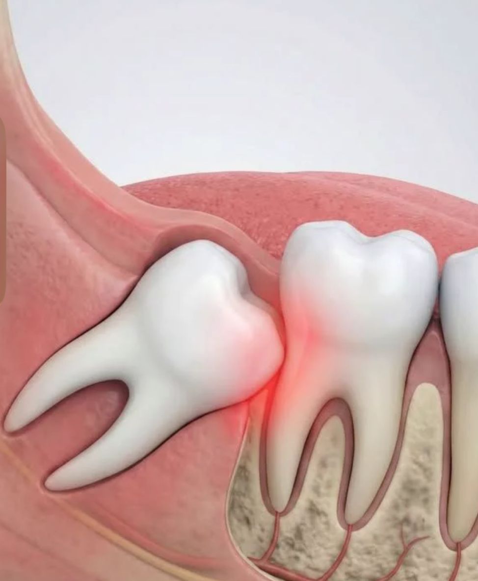 Cirurgia