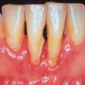 Periodontia